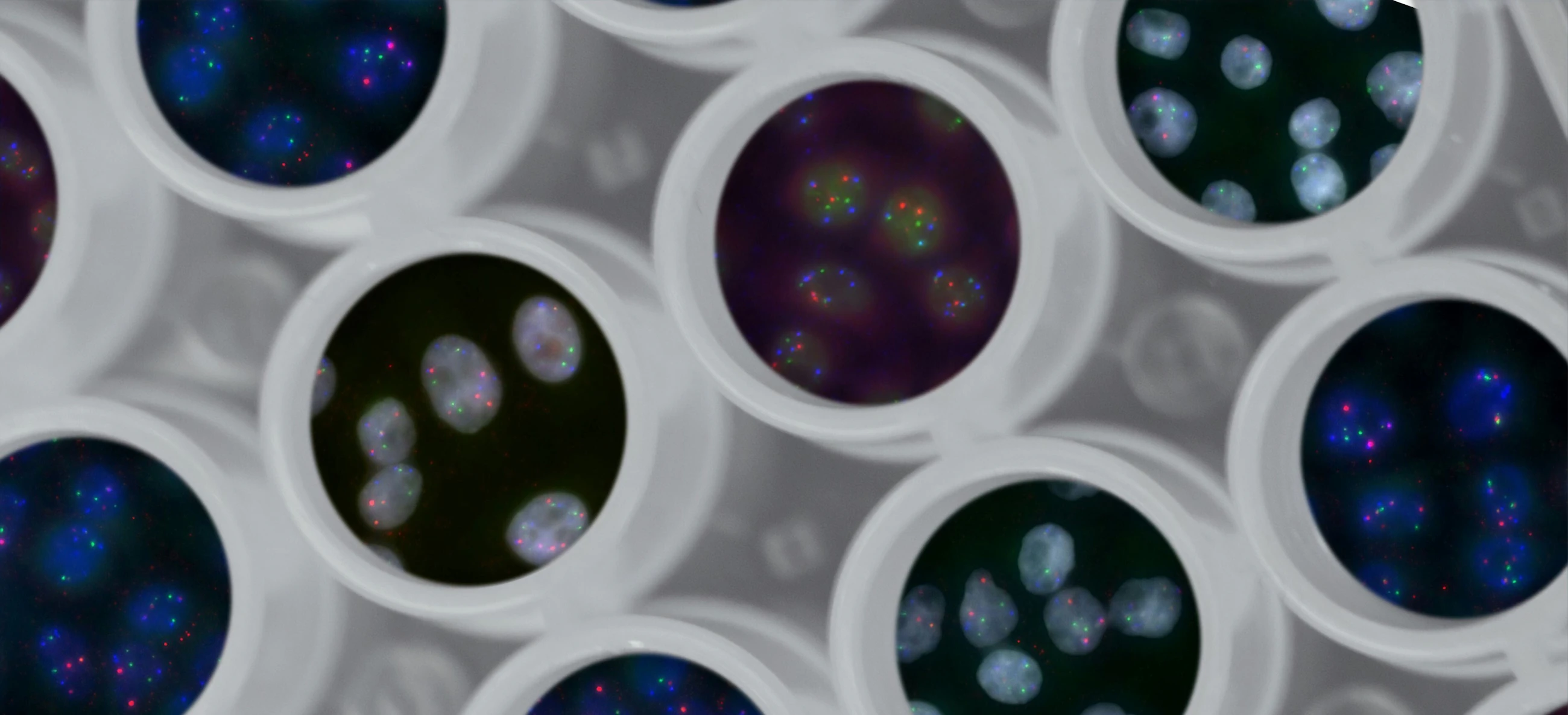 National cancer institute bw Mhq itm MU unsplash 2