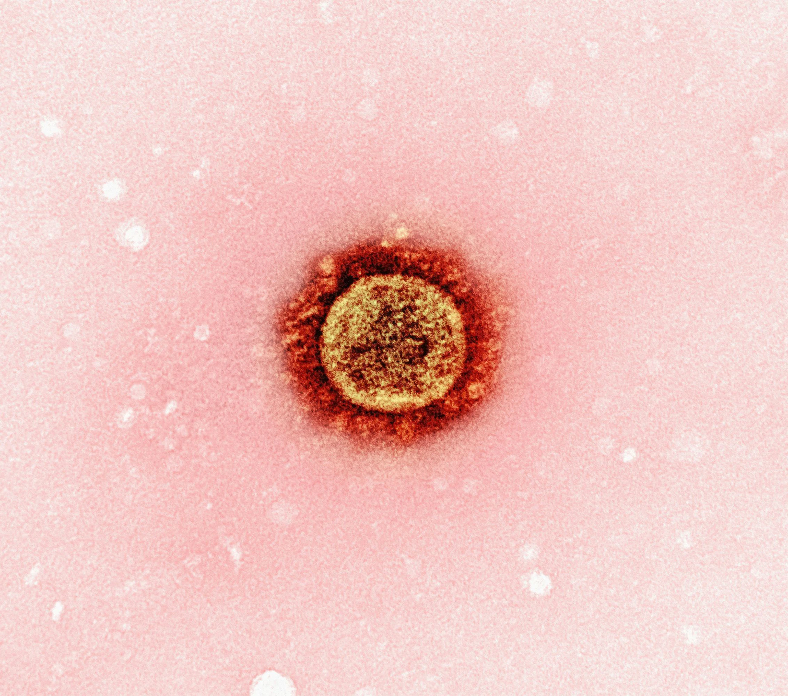 National institute of allergy and infectious diseases lj5 D So92 M3 Q unsplash